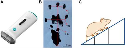 Fabrication of a controlled-release delivery system for relieving sciatica nerve pain using an ultrasound-responsive microcapsule